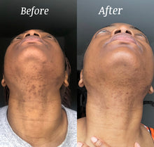 Load image into Gallery viewer, Turmeric &amp; kojic acid facial scrub